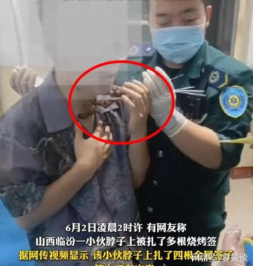 澳门城市大学研究生和脖子被扎多根烧烤签与被烧烤签子扎出血了