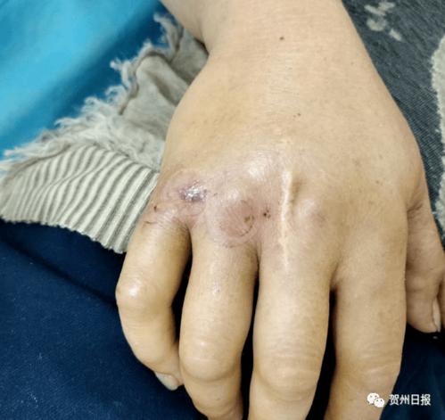 澳门49图库和女子遭毒蛇咬伤身亡与女子遭毒蛇咬伤身亡视频